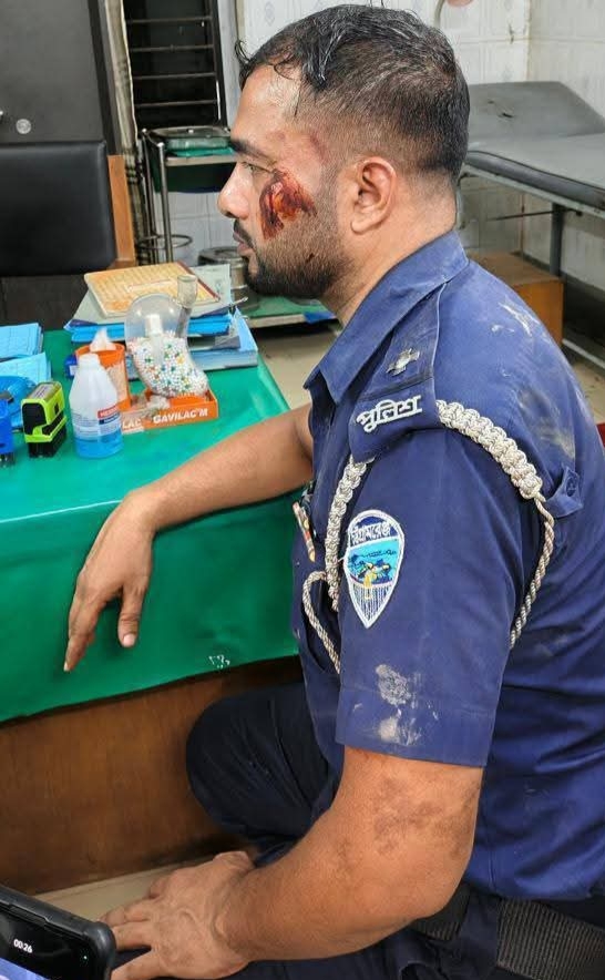 বিজয়নগরে আসামি ধরতে গিয়ে হামলার শিকার পুলিশ, আহত ৬ জন