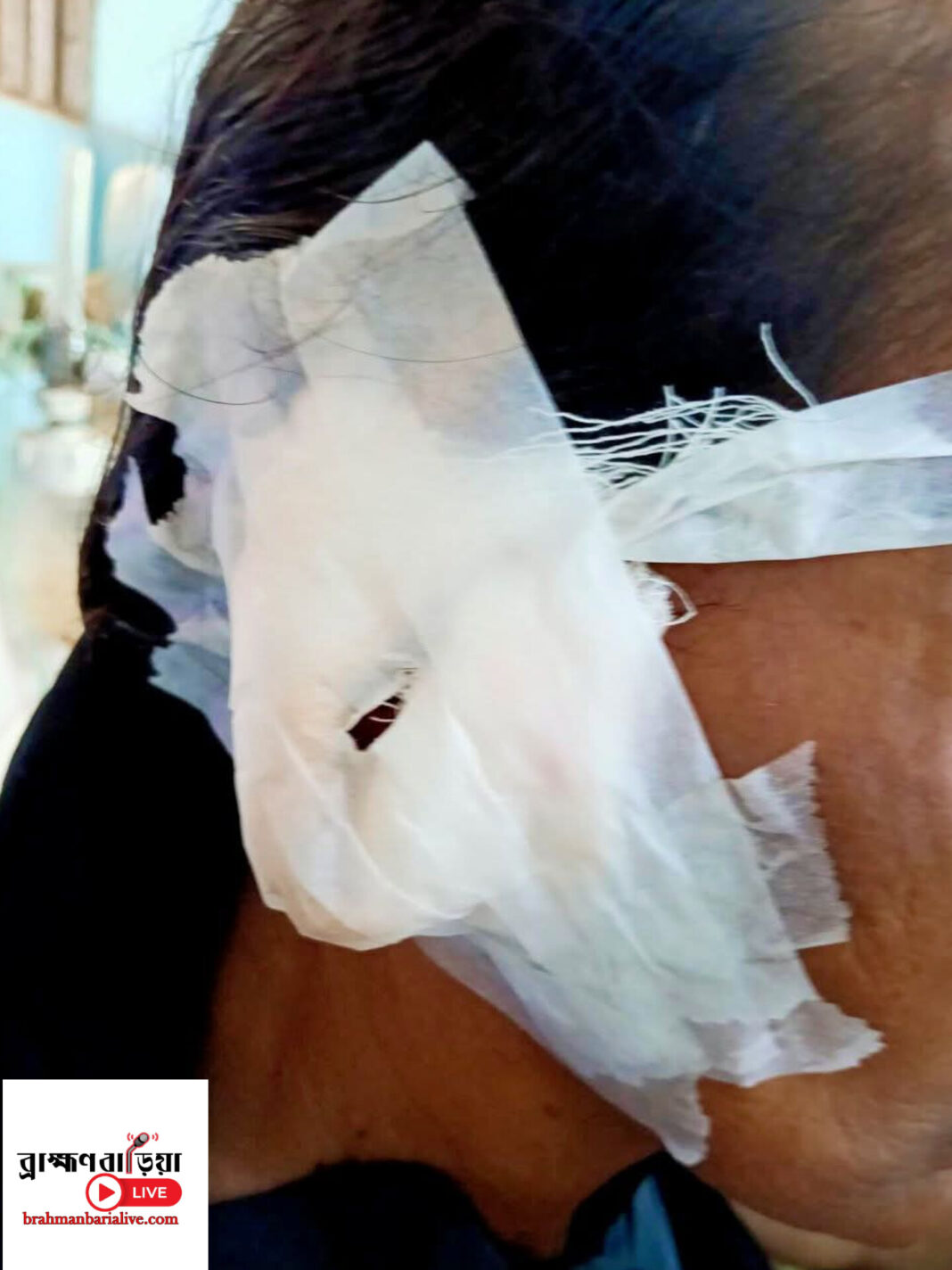 নবীনগরে ডাকাতি: গৃহবধূর কান থেকে দুল ছিনতাই, ১২ সেলাই